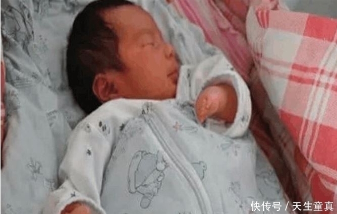 男婴|孕妇生下男婴没有手指,询问夫妇后只因孕期没有注意一个行为