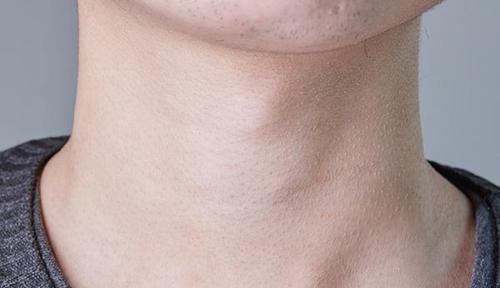 十字花科|提醒甲状腺有结节的人,3种蔬菜若能撤下餐桌,甲状腺会感谢你