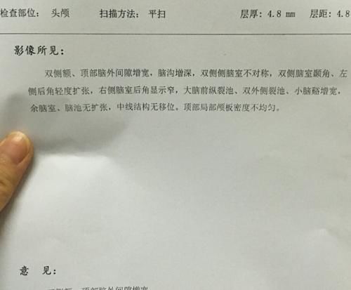 小升初|12岁男孩查出大脑停止发育,脑科医生怒斥:孩子有这2种行为,马上改