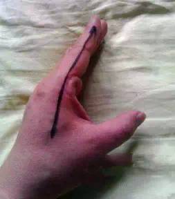 穴位|人体上居然还有“一键关机、一键清理”穴位,收藏以备不时之需!