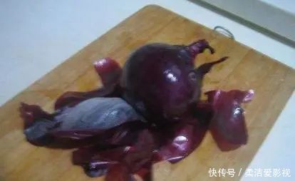 支架|它是能吃的“血管支架”，便宜得不得了！每天一颗，血管干干净净