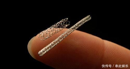 心脏支架手术后，还可以活多久医生终于给出准确答案，早做准备