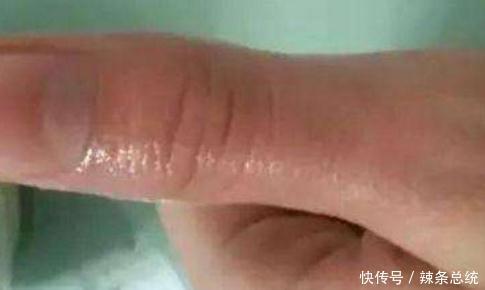  睡眠|睡前不妨在肚脐上滴几滴它，身体会感谢你的做法，安神助睡眠