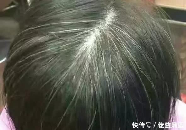 天然的“染发剂”被找到了，有白发每天吃一点，白发慢慢变黑发