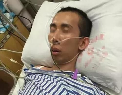 肝脏|40岁男子变成“小黄人”,检查报告写着肝癌晚期,医生:没救了