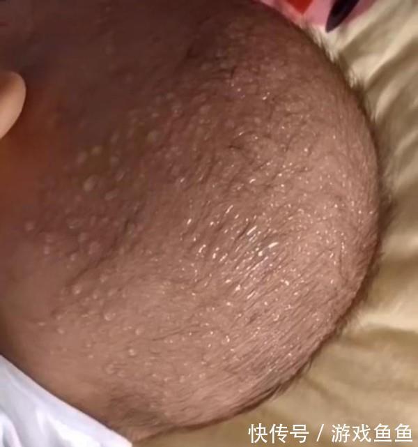 昊昊|10岁男孩身高已有170,医生:2种食物是身高“助长剂”,不妨多吃