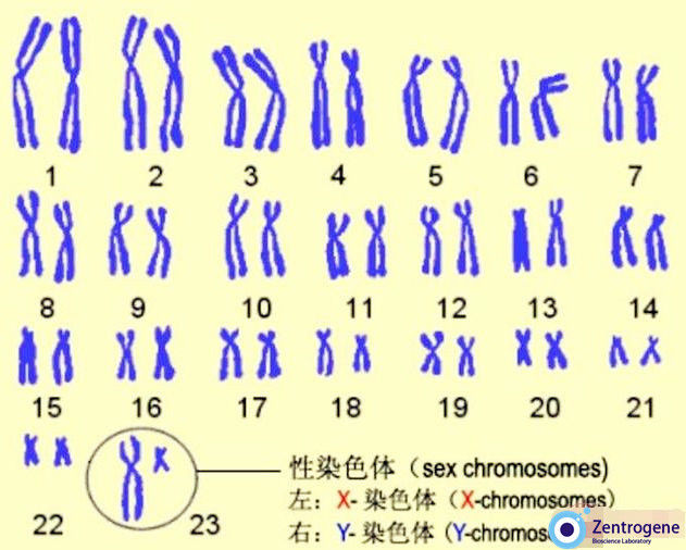 Хромосомы лучше видны. 23 Хромосомы. Пары хромосом. Хромосомы человека. Хромосомный набор человека.