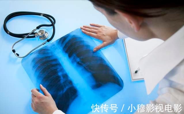 吸烟|戒烟半年,65岁男子查出肺癌,60岁后真的不能戒烟?请看本文