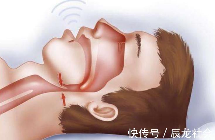 脸型|睡姿影响颜值,除了“张嘴睡”之外,这几种睡姿也会导致娃变丑