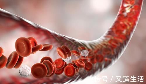 手术治疗|一旦形成就堵塞血管!血栓能自溶?能冲走?真正溶栓方法只有2种