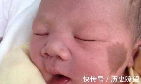 毒素|怀孕后的几件事一定要避免,为了孩子以后的容貌,再喜欢也要克制