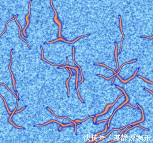 小晴|8岁男孩肝脏长满虫子！医生不要给孩子买这些食物，寄生虫太多