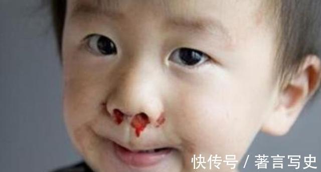 小杰|男孩鼻子流血,爸爸的三个果断做法,值得很多家长学习