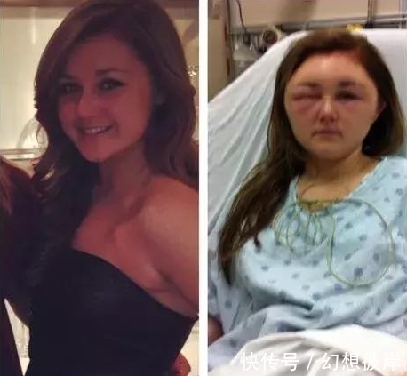 奇闻|奇闻:女孩自己动手染发变成“灯泡脸”,这就是美丽付出的代价