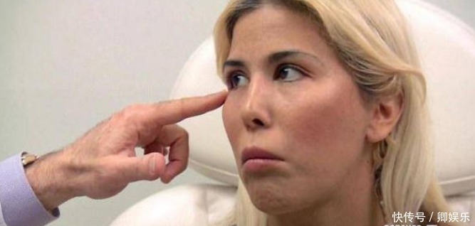 女子花重金整容，一年经历13次整容手术，整容前后判若两人！