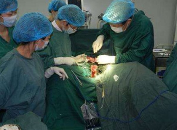 医生|30厘米的黄瓜快顶到心脏了,医生也束手无策,直摇头