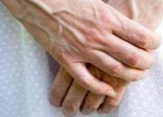 青筋|手上青筋越明显代表身体越差？大实话告诉你真相！早知早受益