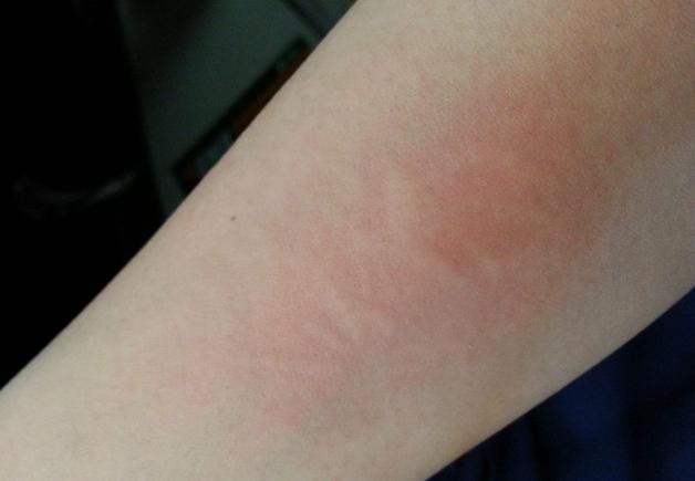 糖尿病早期，身体可能收到此些信号，血糖偏高的人别忽视