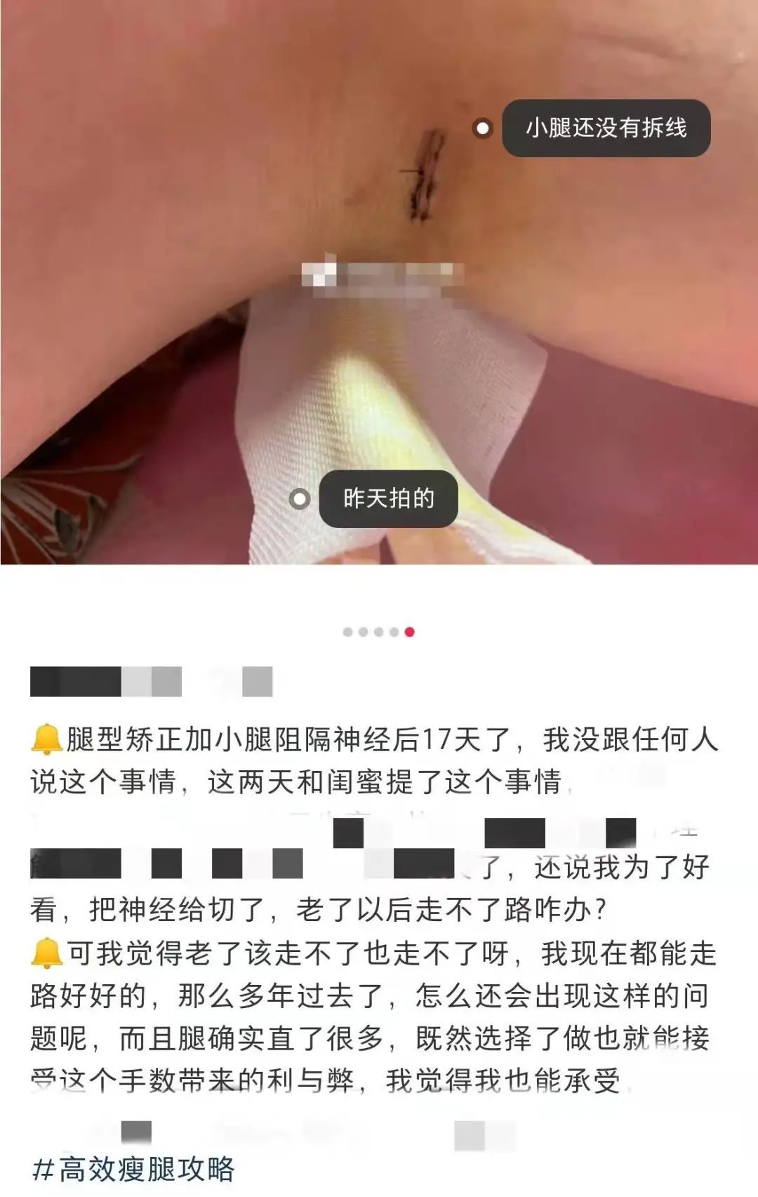 焦虑 离谱！外貌焦虑已经“卷”到动物身上了