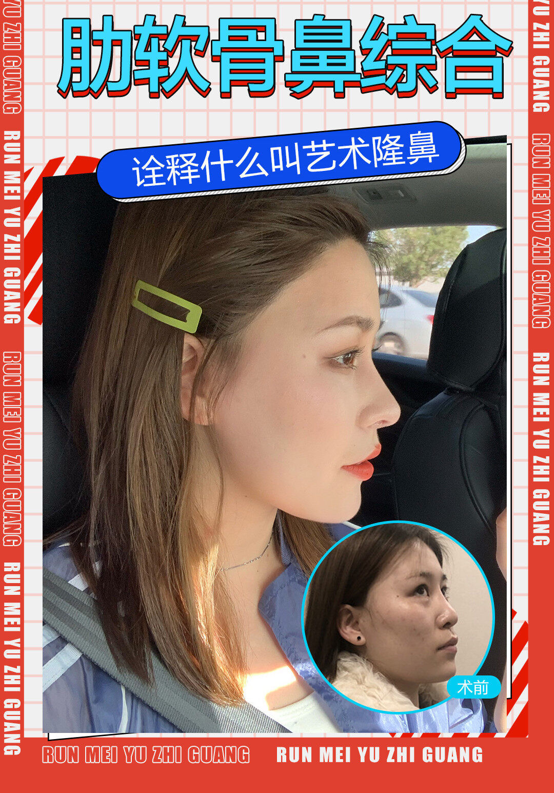 整形|成都润美玉之光黄开亮院长 细节严谨 医者匠心
