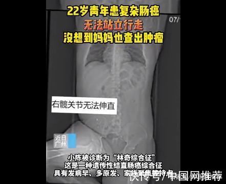 小索|妈妈带儿子看病竟被查出患上同一种癌，经治疗母子二人均获救