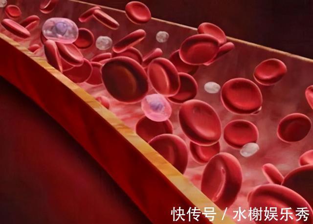 堵塞|你的脑血管会不会堵塞或破裂？医生：教你一个简单的自我评估法