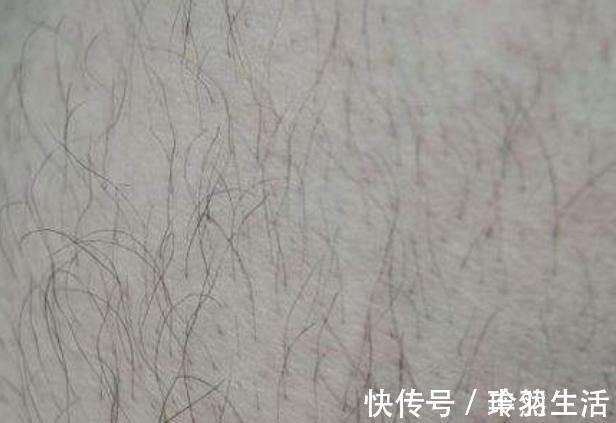 体毛|终于知道女性体毛旺的好处了,别羞于了解