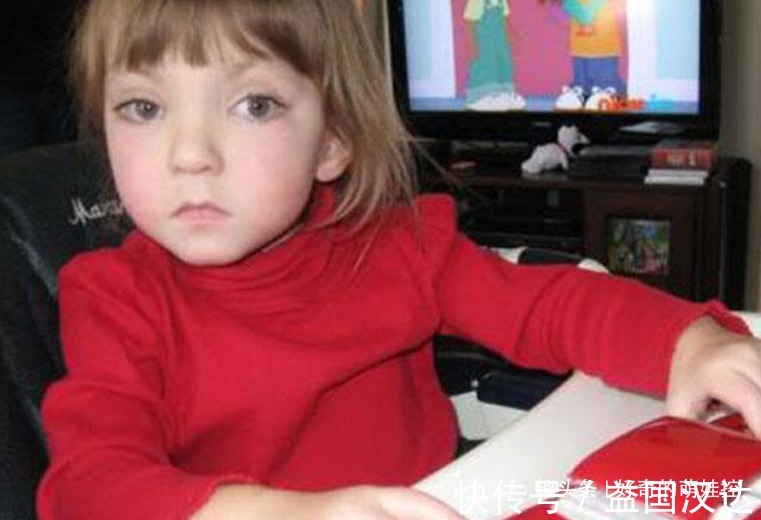 歌舞伎面谱综合征|有一种病叫“孩子太漂亮”,天生自带眼妆,是产检查不出的罕见病