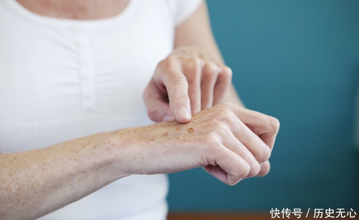 手机|老年斑是怎么形成的,还没到60,就已经有了,有些人却干干净净