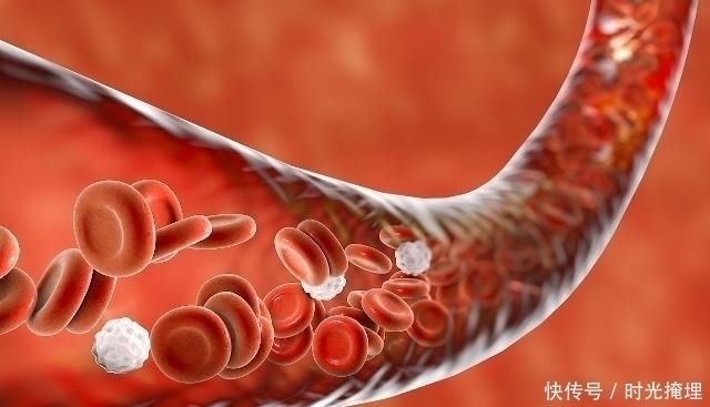 血管堵塞|每天坚持吃几粒,或许助你“清肠化栓”,血栓也不会靠近你