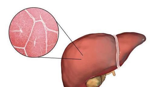 肝脏|有脂肪肝的人, 建议多吃这些食物, 帮你清理肝内脂肪, 肝脏更健康