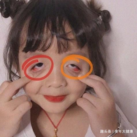 初潮|女孩子几岁“来月经”算合格医生“这岁数”才正常，请别忽视