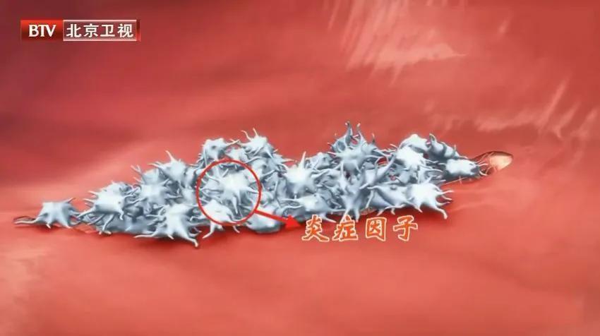 副作用|他汀的副作用不只是伤肝!还能不能吃用好它血管通畅更健康