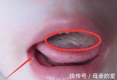 身高|11岁女童身高已有163，医生：3种食物是“助长王”，可多吃