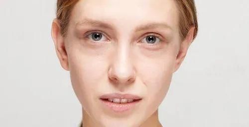 不想走近色斑“重灾区”？教你几招预防色斑