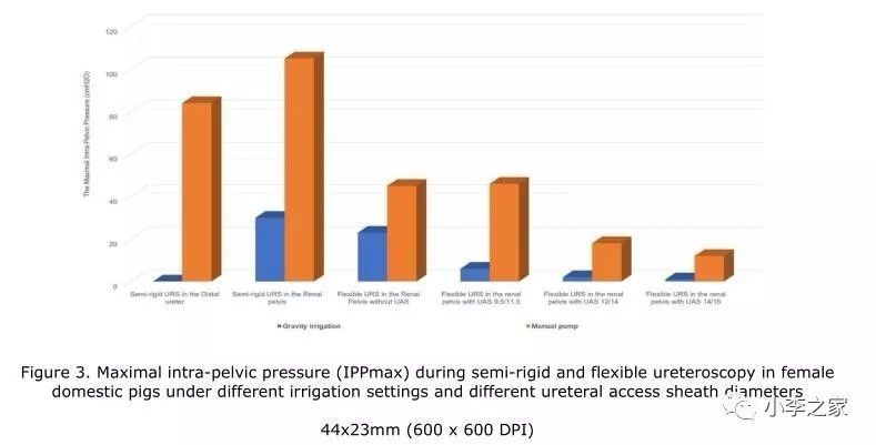 cm|灌流率和输尿管鞘直径对输尿管镜手术最大肾盂内压（IPPmax）的影响