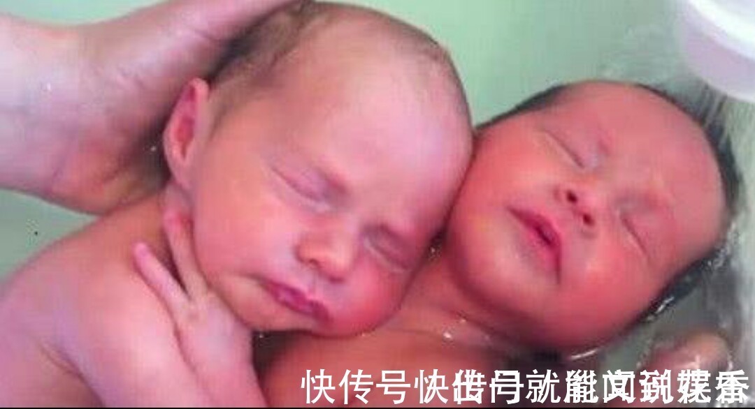 双胞胎|刚出生的双胞胎,被医生转身放进水里,俩宝宝反应太萌了