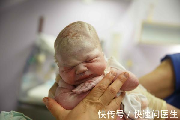 胎位不正|顺产与剖宫产,若胎儿或胎位有异常,选择剖宫产可能更稳妥