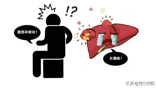 症状|体内有癌,肚子第一个发声?这2种异常表现,是肝脏癌变信号?