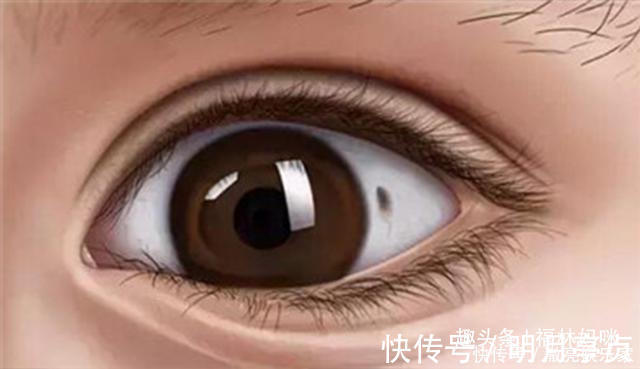 黑色素|孩子眼白上的黑斑是什么爸妈别慌,可能是这两种情况