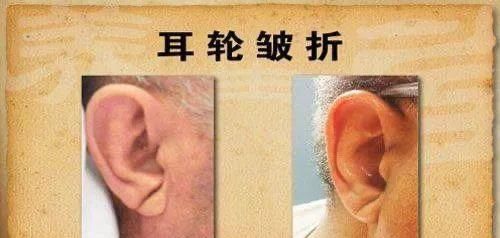  发现|有没有冠心病？一手一脸就能辨！中医教你发现端倪，3招去除病根