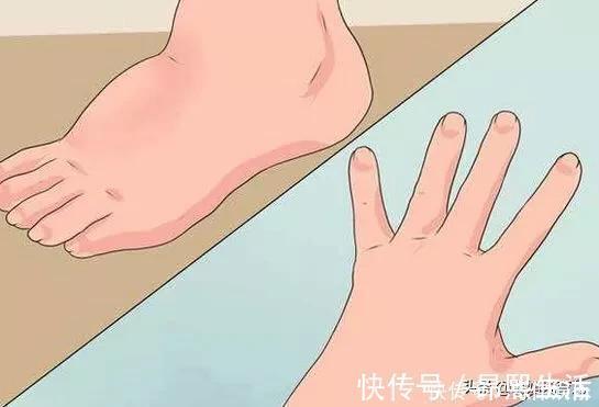 一个月|孕期有多辛苦,各人区别很大,有的宝宝在娘胎里就知道疼惜妈妈了