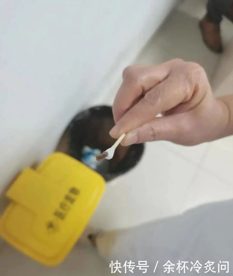 王先生|是个狠人男子眼睛反复发炎一年多,医生一翻眼皮竟掏出一截…