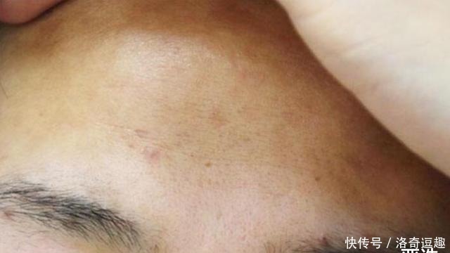 肌肤|国内有款“不起眼”洁面皂,因价低受冷落,却能抑菌除螨消痘