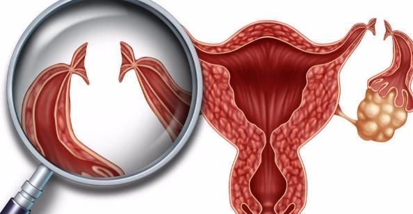 身体|月经延迟和提前哪个更好？对身体有什么危害，大多数女人不清楚！