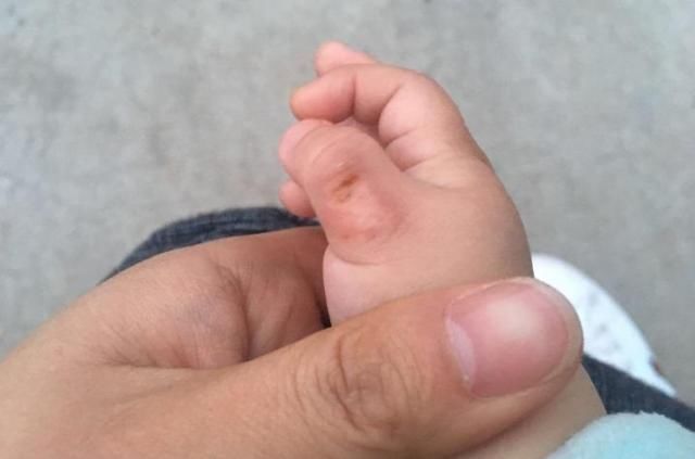 小宝宝|为什么小宝宝都喜欢吃手指?不同月龄,原因不同,妈妈要清楚