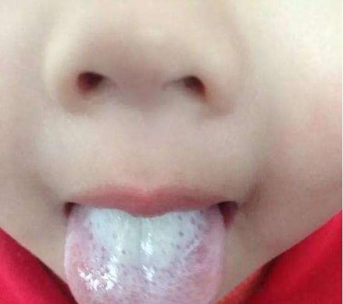 消食方|吃一次胜过吃6瓶奶,医生:孩子若爱吃,孩子更长个