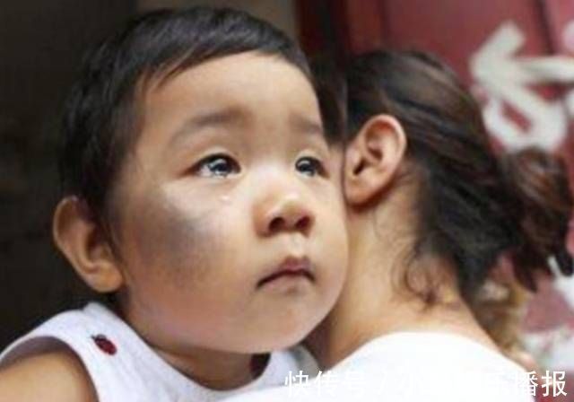 孕妇|孕妈再不改掉这些“坏习惯”,当心宝宝“胎记缠身”,别再固执了