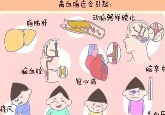 血管|高血脂“克星”公开,避免做这几件事,血管干净通畅