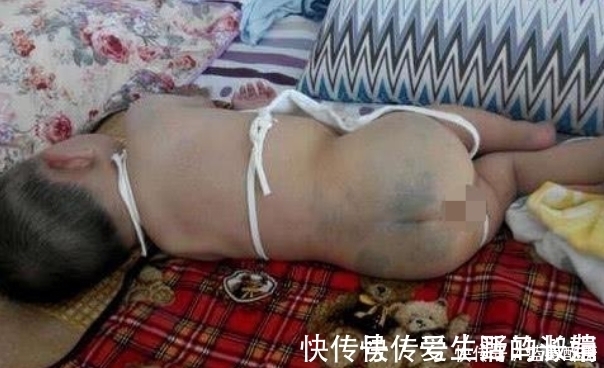 小孩|奇闻!小孩身上的印记竟是这个,原以为是被打的,结果意外